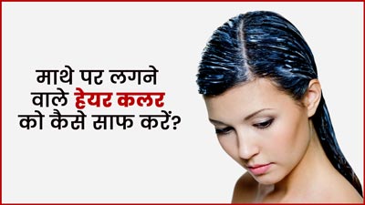 माथे और गर्दन पर लगा हेयर कलर हटाने के लिए अपनाएं ये 5 घरेलू उपाय 