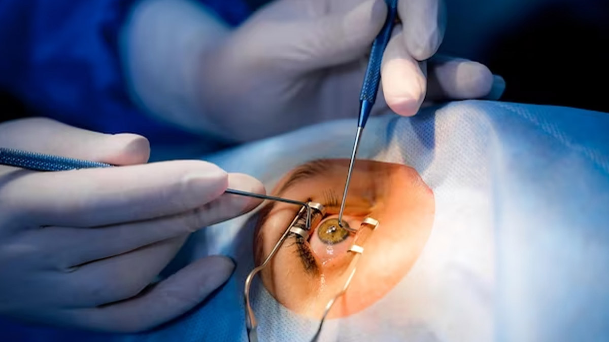 dry-eye-after-lasik-surgery-expert-explains-how-to-manage-the