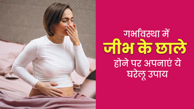 प्रेग्नेंसी में जीभ के छाले होने पर अपनाएं ये घरेलू उपाय, मिलेगा जल्द आराम