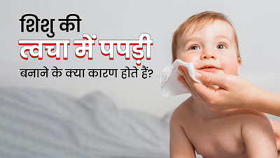 शिशु की त्वचा की ऊपरी पर्त निकलने के क्या कारण हो सकते हैं? डॉक्टर से जानें इसका इलाज