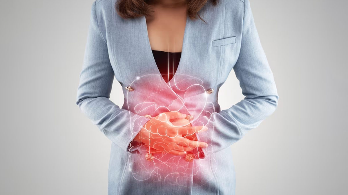 Inflammatory Bowel Disorders: Long-Term Complications To Watch Out For