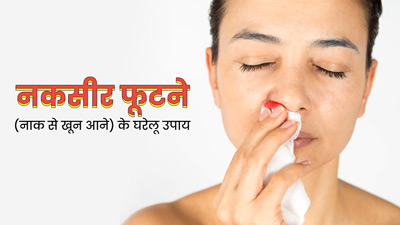 गर्मियों में नकसीर फूटने (नाक से खून आने) की समस्या में करें ये 5 घरेलू उपाय