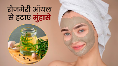 मुंहासे ठीक करने के लिए करें लगाएं रोजमेरी तेल, जानें प्रयोग के आसान तरीके 