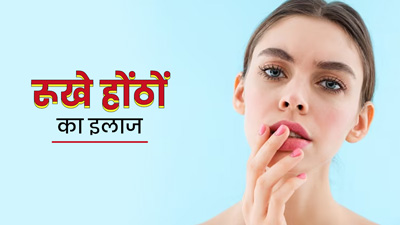 गर्मी में रूखे और फटे होठों को ऑल‍िव ऑयल से बनाएं सॉफ्ट, ऐसे करें इस्‍तेमाल 