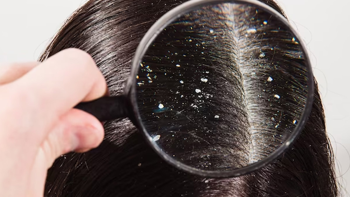 Aloe Vera Hair Mask For Frizzy Hair