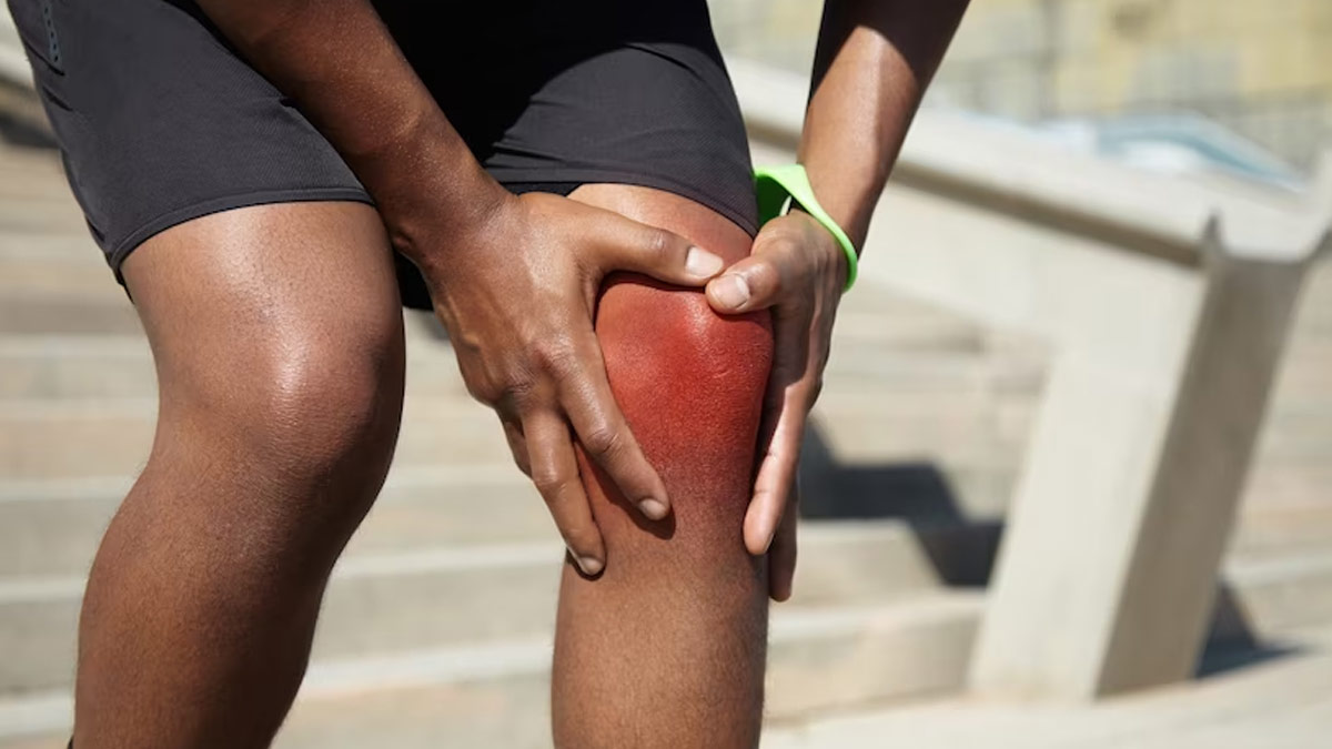 From Ageing To Lifestyle Factors: Here Are 9 Reasons Why You Bruise Easily