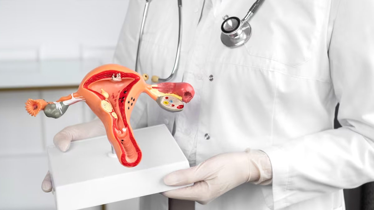 uterine cancer after menopausal 