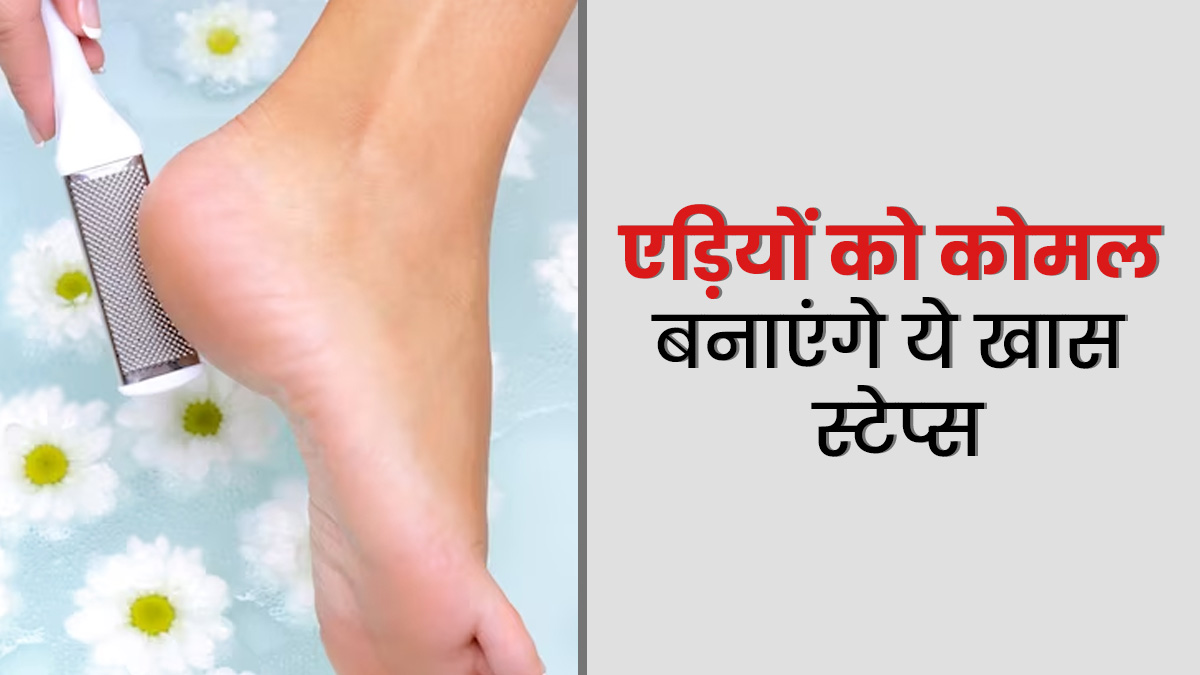 गर्मी में रूखी और फटी एड़ियों को बनाएं कोमल, फॉलो करें ये आसान स्‍टेप्‍स