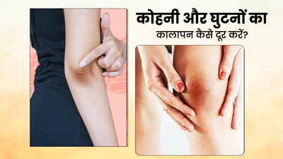 कोहनी और घुटनों का कालापन दूर करेगा बादाम तेल, इस तरह करें इस्‍तेमाल 