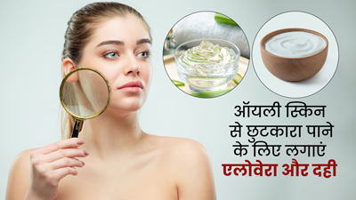 ऑयली स्किन से छुटकारा पाने के लिए लगाएं एलोवेरा और दही, चेहरे में आएगा निखार