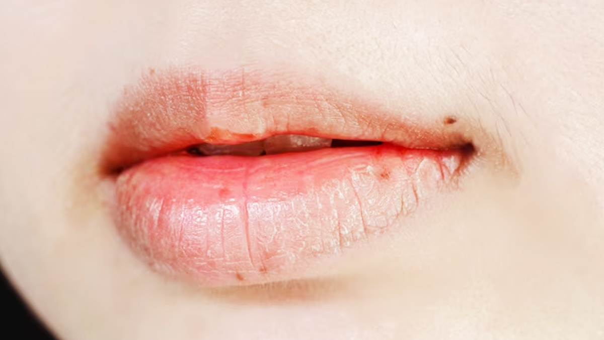 Jojoba Oil Benefits For Lips