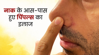 नाक के आस-पास निकलने वाली फुंसी दूर कर सकता है गुलाब जल, जानें इस्‍तेमाल का तरीका