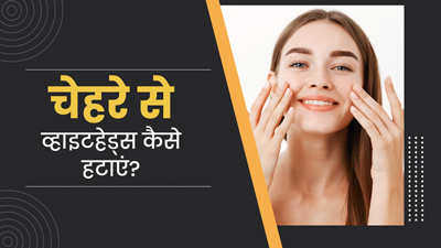 चेहरे के व्हाइटहेड्स हटाने के लिए ट्राई करें ये 5 घरेलू उपाय