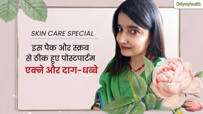 डिलीवरी के बाद मुंहासों, दाग-धब्बों ने खराब कर दिया था चेहरा, साक्षी ने इस तरह दोबारा पाया पहले जैसा ग्लो