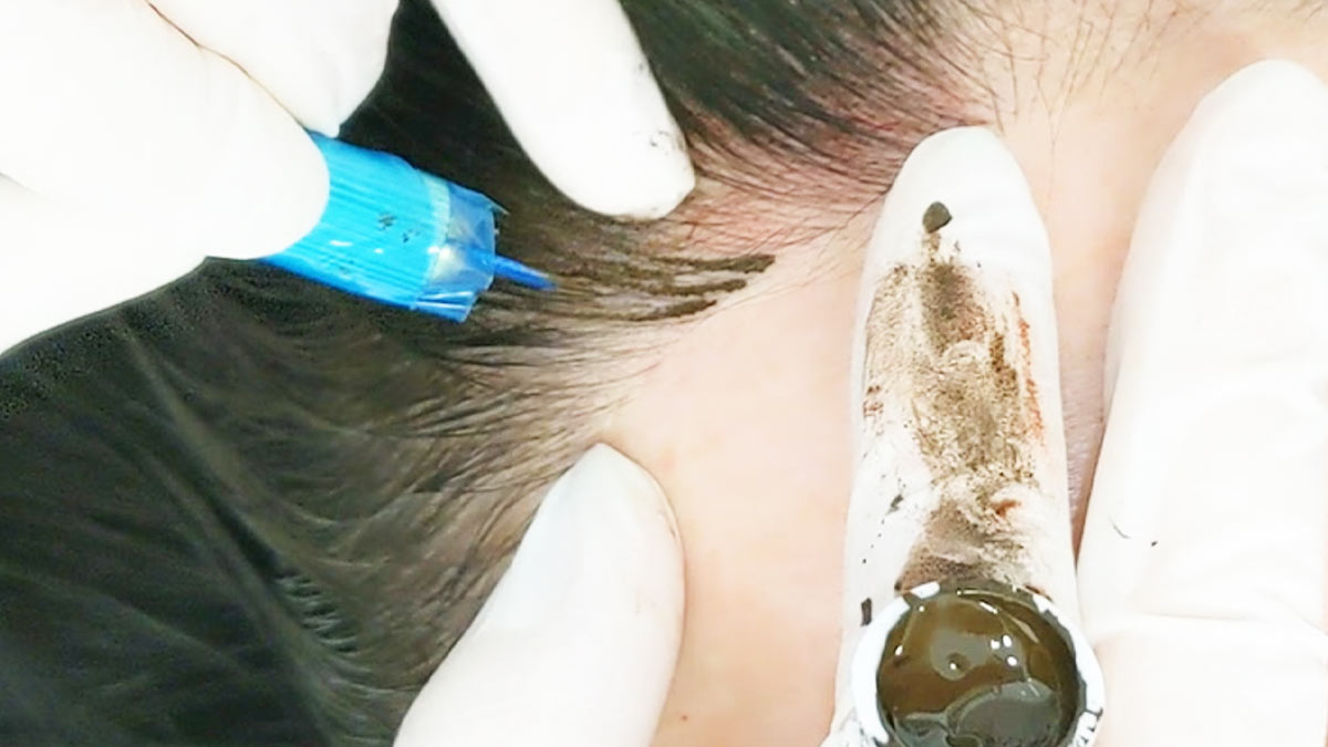 hairline microblading