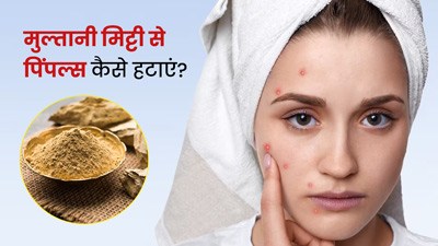 मुल्तानी मिट्टी से चेहरे के मुंहासे कैसे हटाएं? जानें 4 तरीके, जिनसे मिलेगी निखरी-बेदाग त्वचा