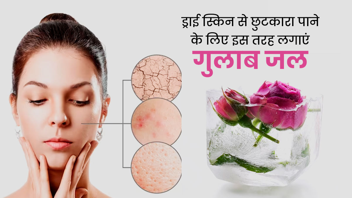 रूखी त्वचा से छुटकारा पाने के लिए इस तरह लगाएं गुलाब जल