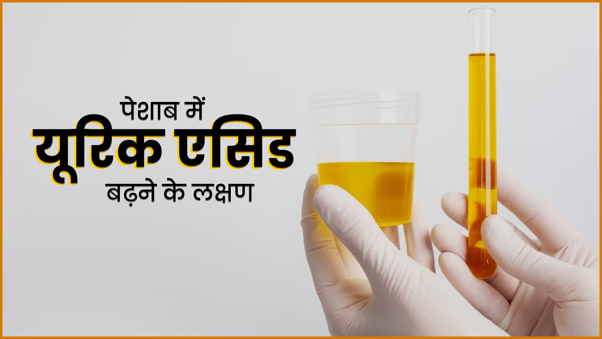 पेशाब में यूरिक एसिड बढ़ने पर दिखते हैं ये 5 लक्षण, डॉक्टर से जानें