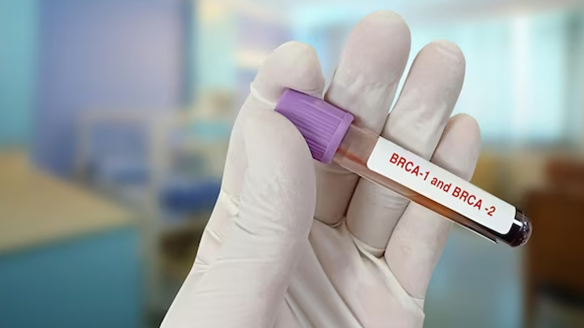 Empowering Genetic Testing The Role Of Brca1 And Brca2 Testing In