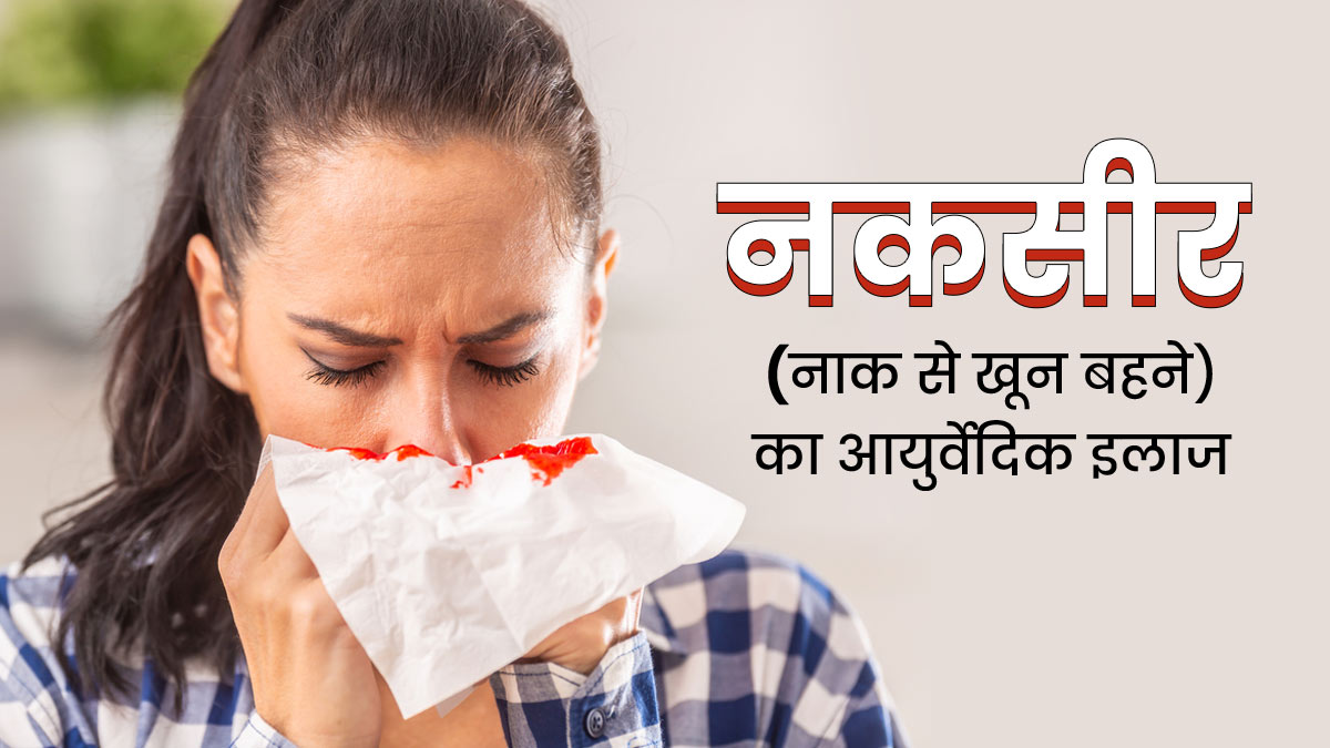 नकसीर फूटने (नाक से खून बहने) पर अपनाएं 5 आयुर्वेदिक उपाय, मिलेगी जल्द राहत