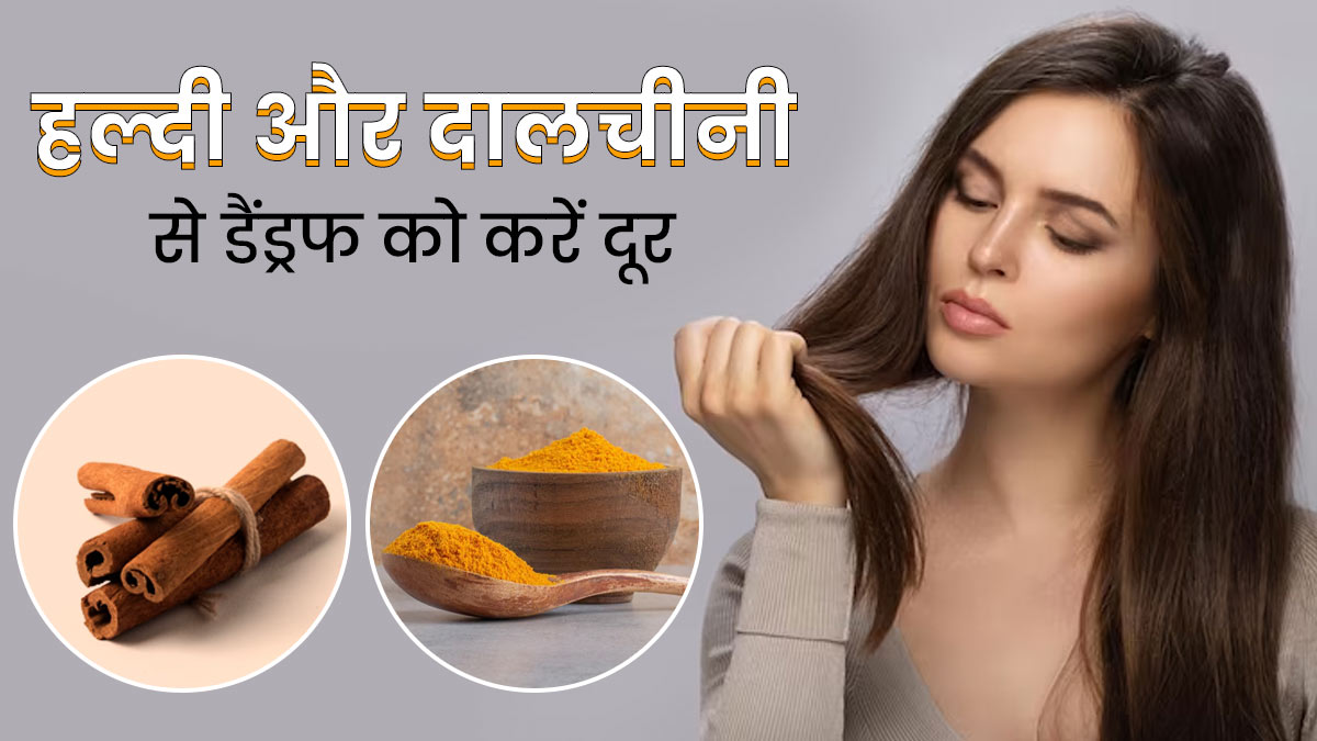 हल्दी और दालचीनी हेयर मास्क से मिलेगा डैंड्रफ से छुटकारा, जानें इसे बनाने और लगाने का तरीका