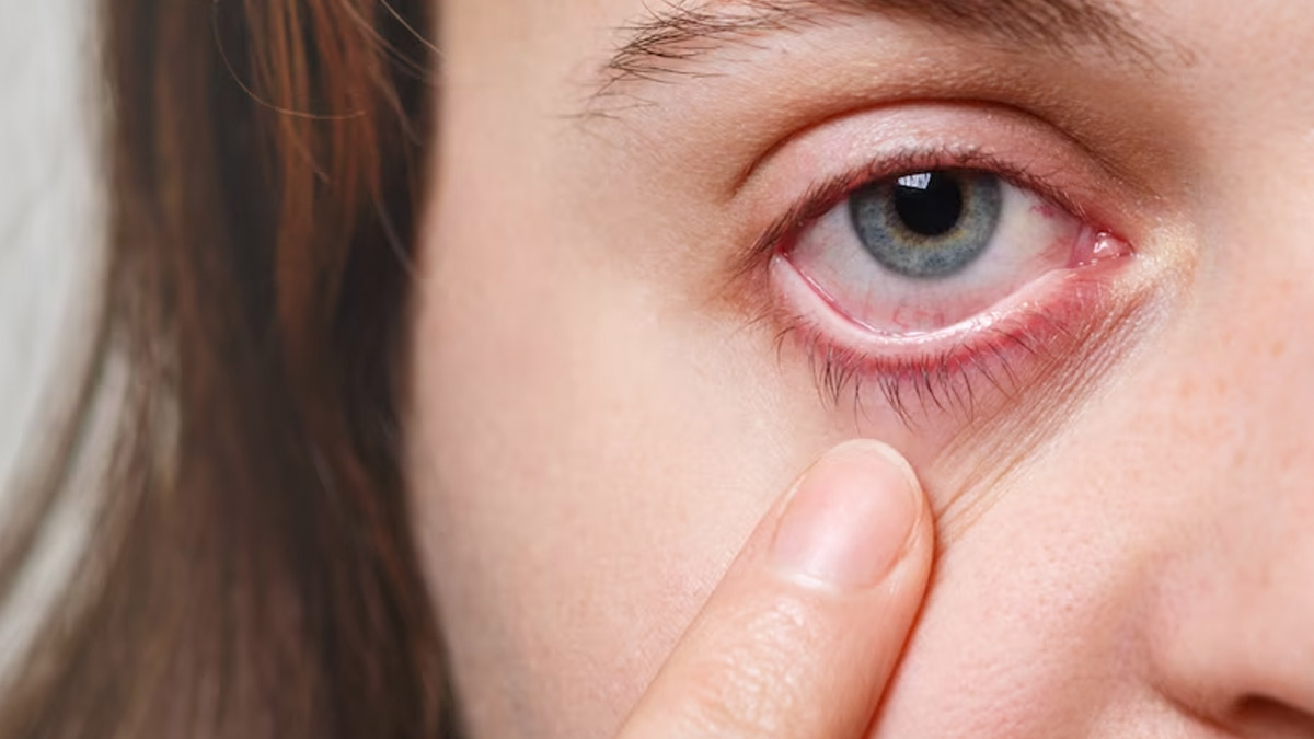 Why Does My Vision In One Eye Suddenly Turned Cloudy? | OnlyMyHealth