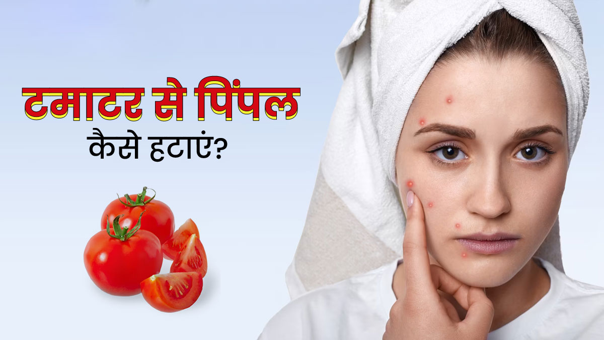 मुंहासे हटाने के लिए इस तरह करें टमाटर का प्रयोग, दाग-धब्बों से भी मिलेगा छुटकारा