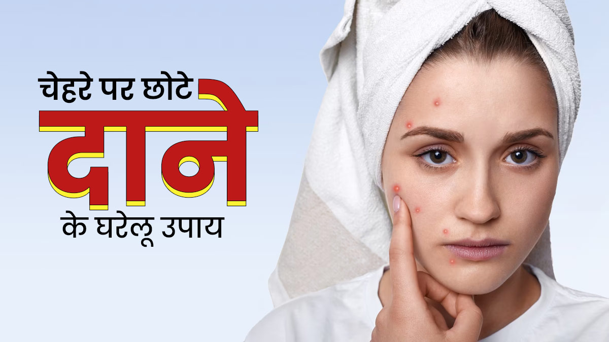 चेहरे पर हो गए हैं छोटे दाने? अपनाएं ये 5 घरेलू उपाय, जिनसे साफ होगी स्किन