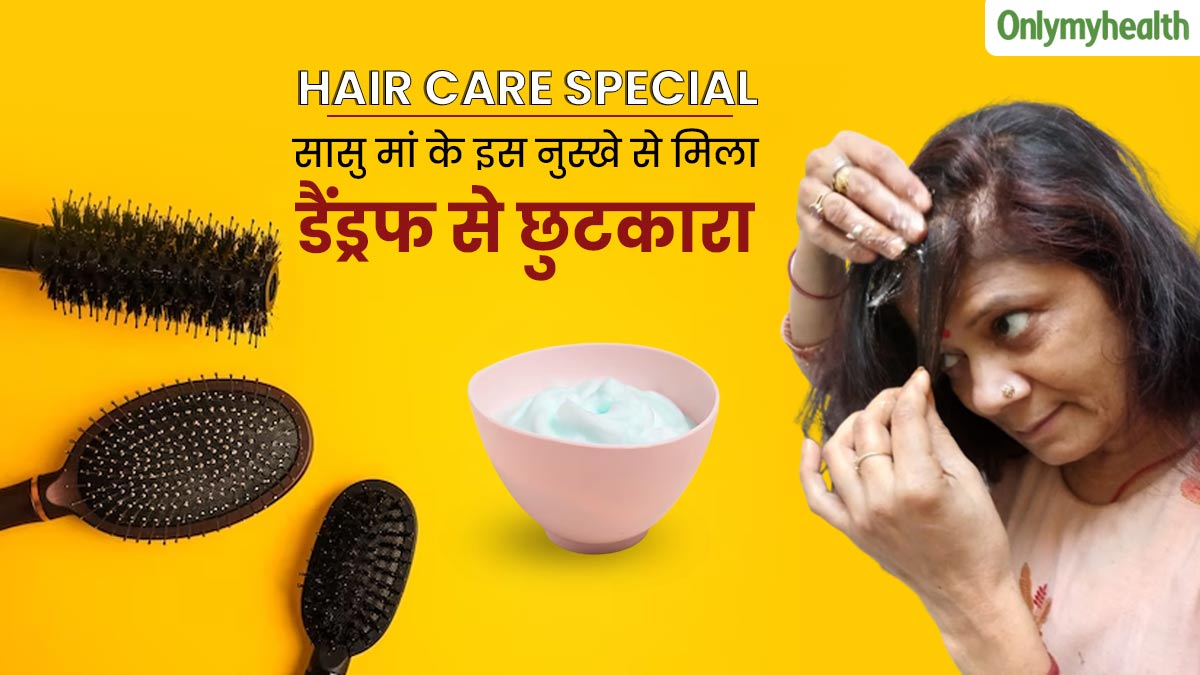 बालों में डैंड्रफ होने पर पूनम ने अपनाया सास का बताया यह घरेलू नुस्‍खा, पहली ही बार में द‍िखा असर