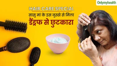 बालों में डैंड्रफ होने पर पूनम ने अपनाया सास का बताया यह घरेलू नुस्‍खा, पहली ही बार में द‍िखा असर