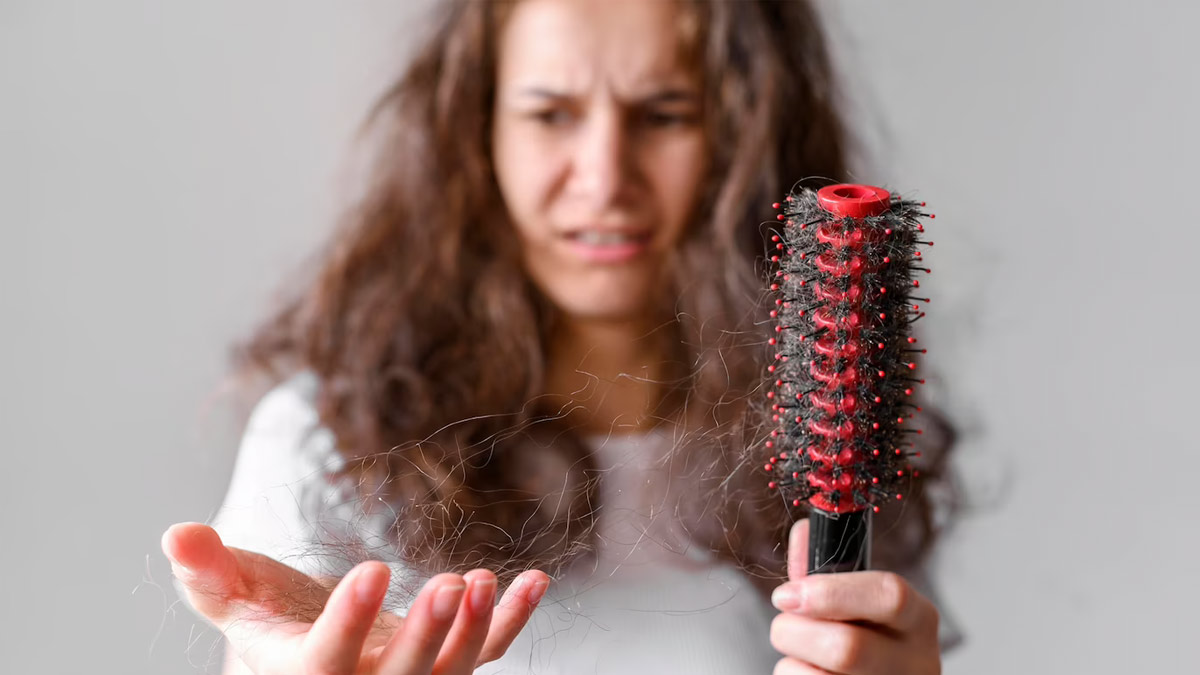 hair fall