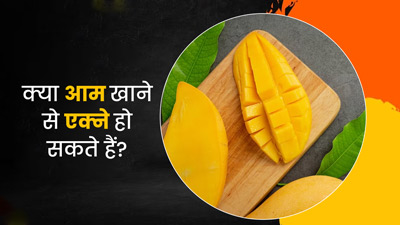  क्या आम खाने से मुंहासे होते हैं? जानें एक्सपर्ट से