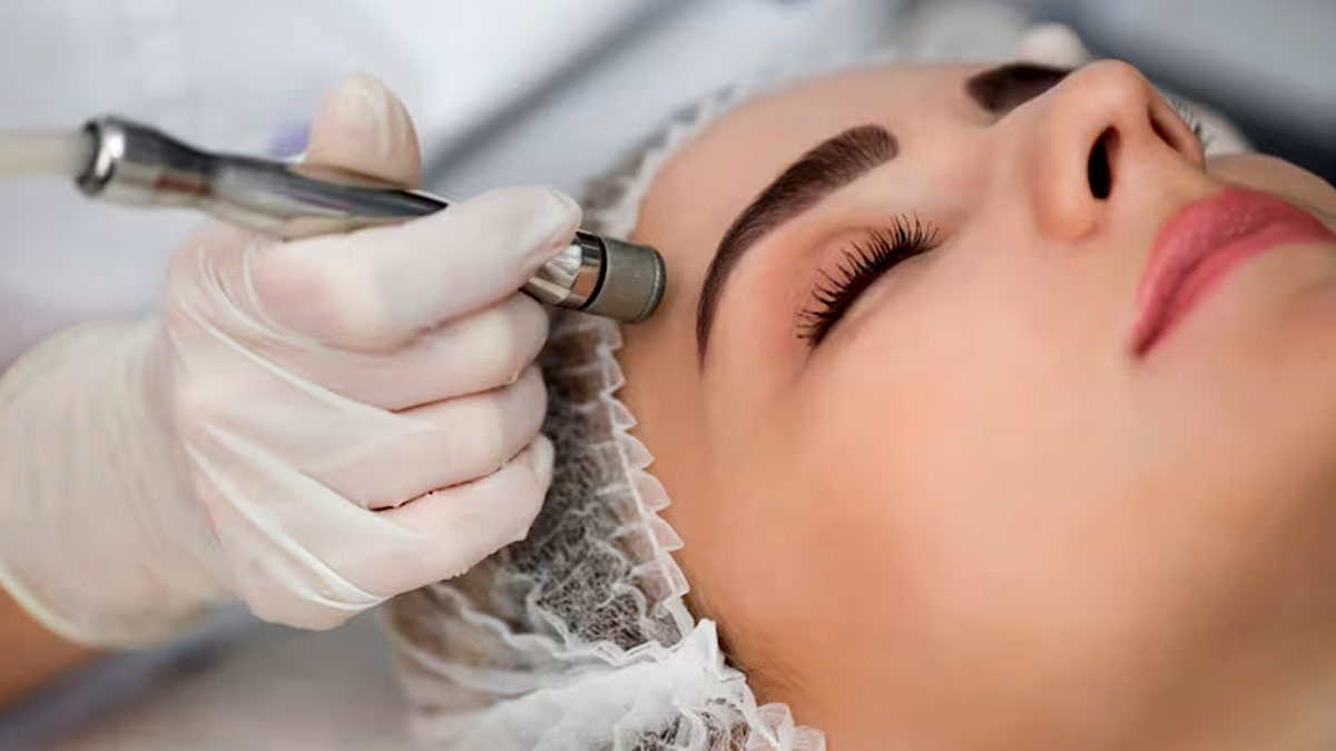 Microdermabrasion Expert Explains This Powerful Cosmetic Procedure