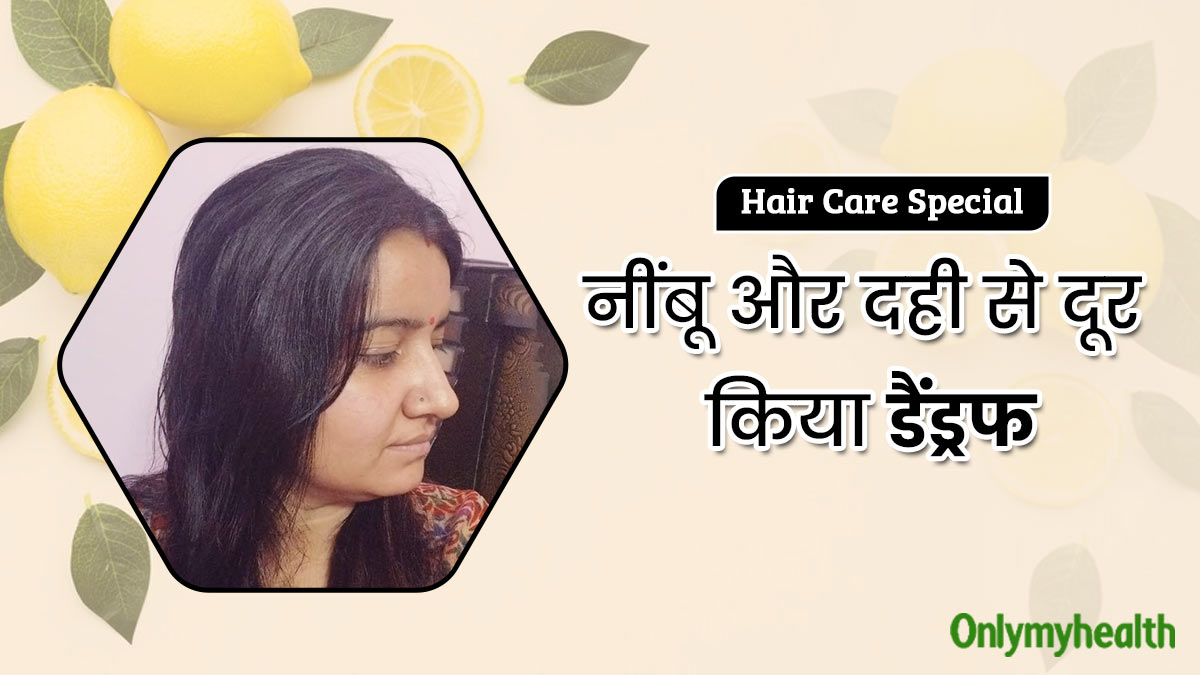 डैंड्रफ और खुजली से परेशान रहती थीं रुपाली, इस हेयर मास्क के इस्तेमाल से दूर हुई समस्या  
