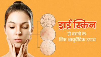 सर्दियों में ड्राई स्किन से बचने के लिए क्या करें? आयुर्वेदाचार्य से जानें टिप्स