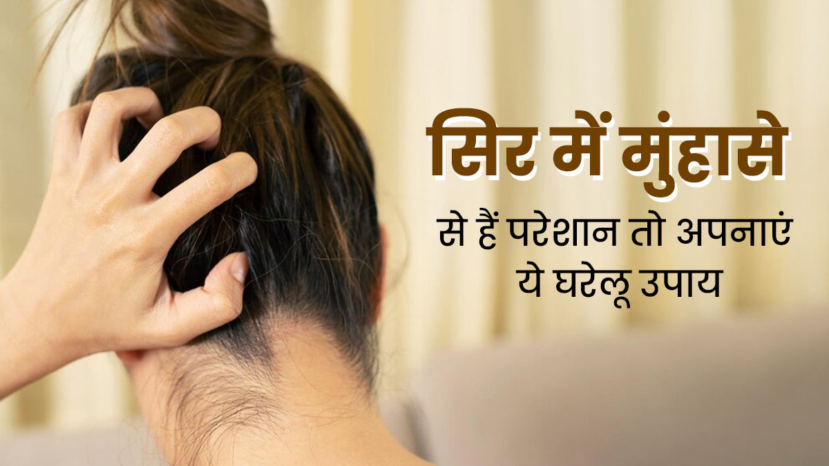 सिर पर हो जाते हैं फोड़े-फुंसियां, तो राहत पाने के लिए अपनाएं ये 5 घरेलू उपाय