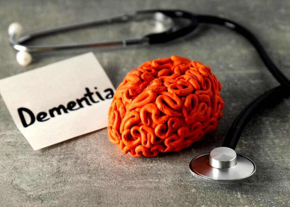 Bruce Willis Dementia