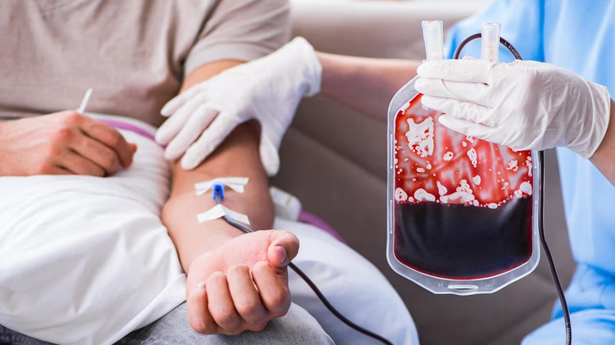 platelet-transfusion