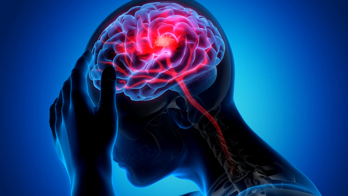 Stroke Recovery Tips: स्ट्रोक से रिकवरी करने में मदद करेंगे ये 5 ट‍िप्‍स, रोज करें फॉलो 