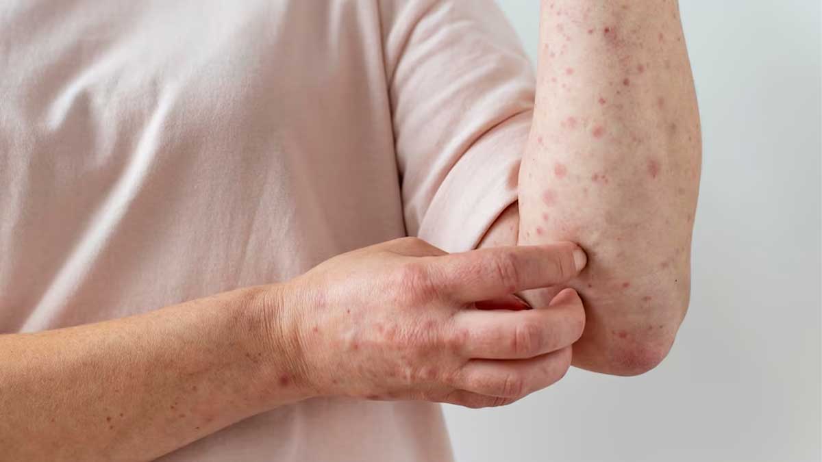 Paramyxoviruses Group Can Cause The Next Pandemic