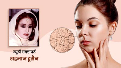 ब्यूटी एक्सपर्ट Shahnaz Husain से जानें सर्दियों में ड्राई स्किन से छुटकारा पाने के टिप्स