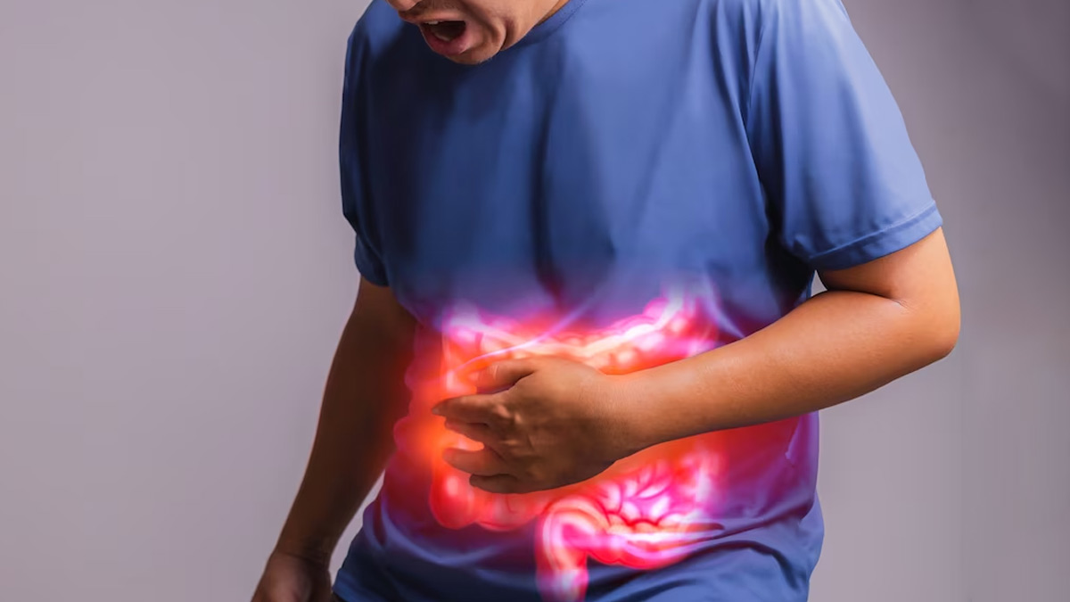 Ulcerative Colitis: Expert Explains The Disease And Lists Dietary Measures  To Follow