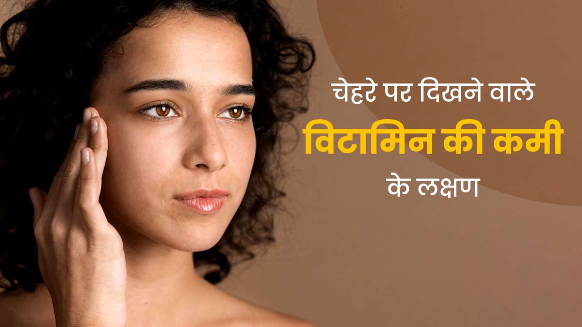 चेहरे पर दिखे ये 5 लक्षण, तो समझ जाए शरीर में है विटामिन्स की कमी