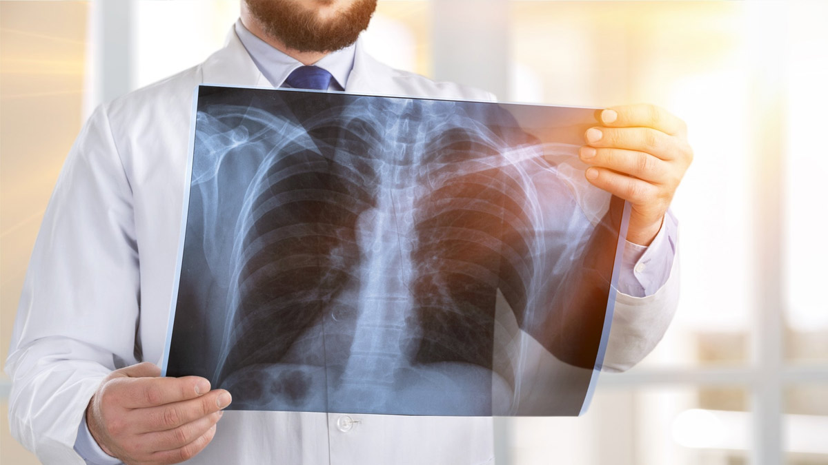 World Pneumonia Day Date History Significance and Theme