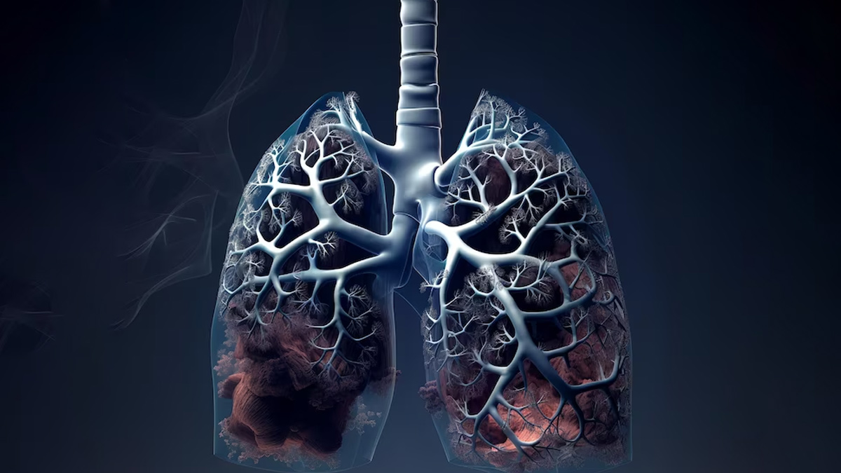 Symptoms Of Bronchopneumonia