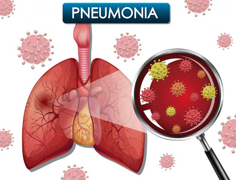 How Does Normal Cold And Cough Become Pneumonia 