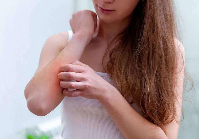 skin allergy