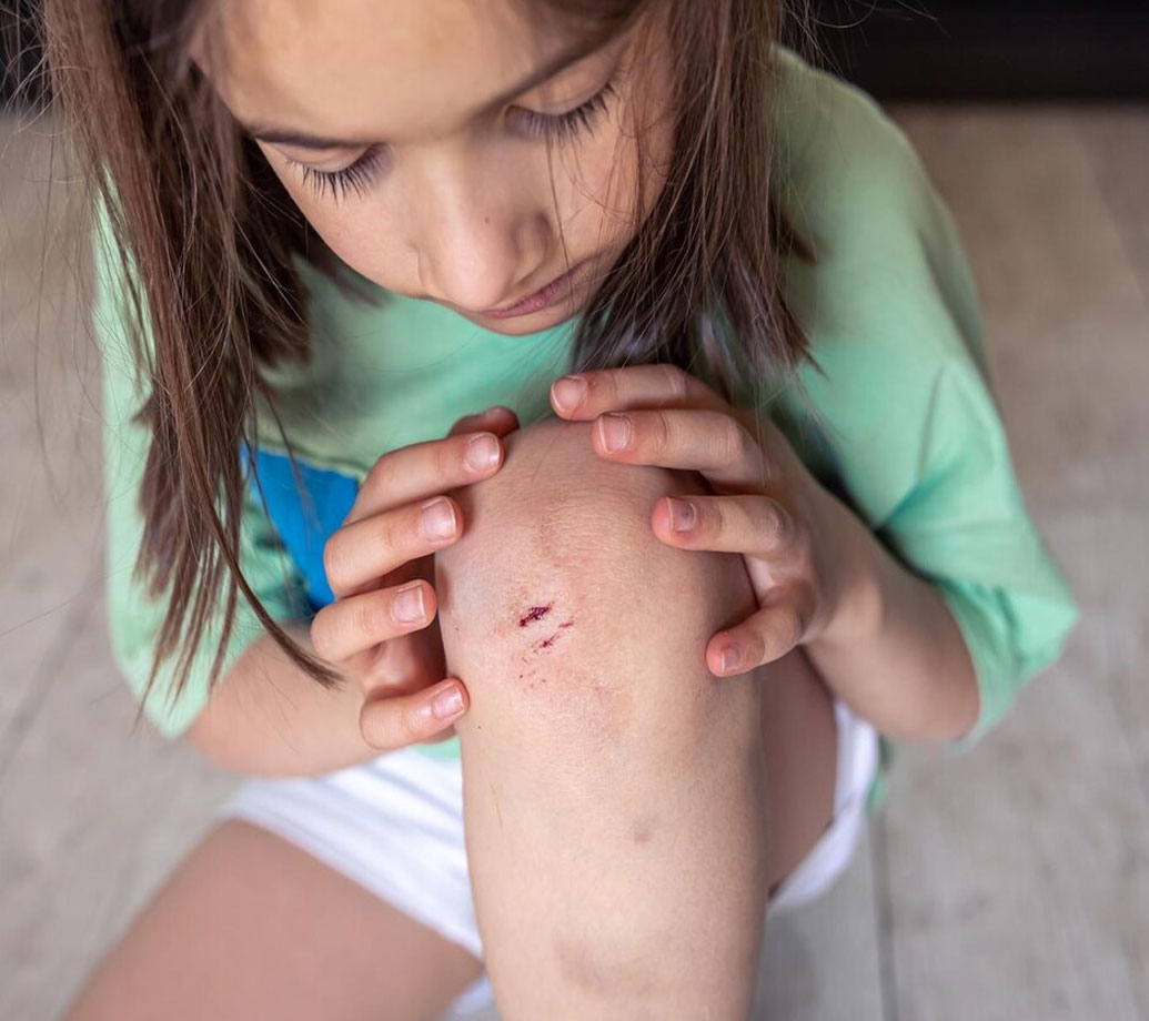 Wild Honey For Skin Care