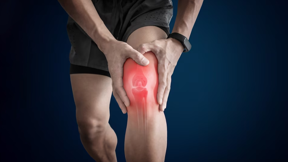 Dengue Causes Arthritis