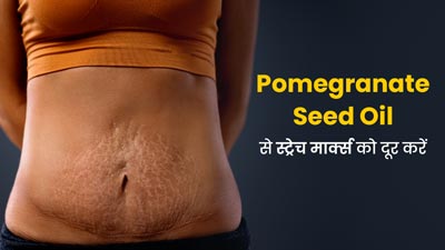 स्ट्रेच मार्क्स दूर करने में मदद करेगा अनार के बीजों से बना तेल, जानें इसके फायदे और इस्तेमाल का तरीका